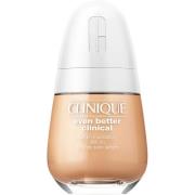 Clinique Even Better Clinical Serum Foundation SPF20 CN 18 Cream Whip ...